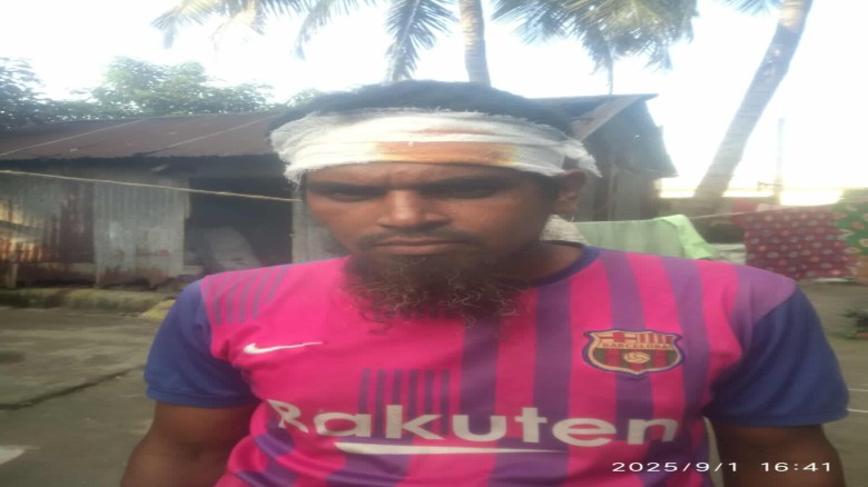 মির্জাপুরে বিএনপি নেতার পোষ্টার ছেড়ার ঘটনায় দুই পক্ষের সংঘর্