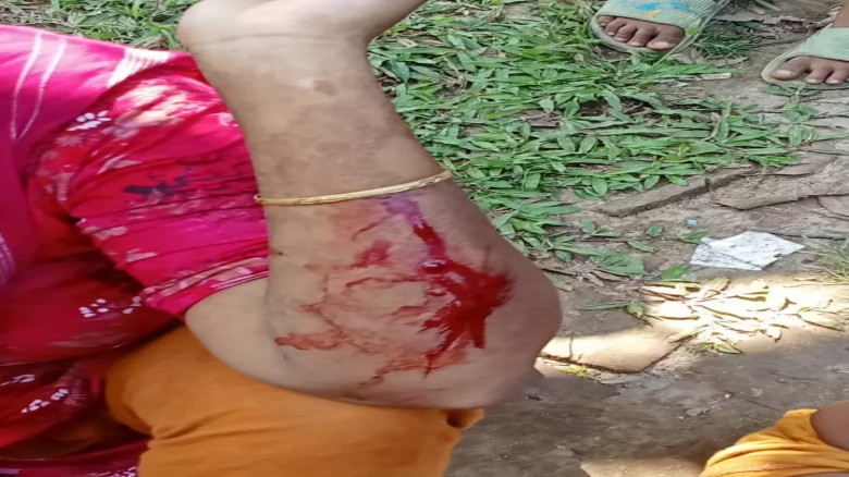 মির্জাপুরে প্রতিপক্ষের হামলায় নারীসহ ৪ জন আহত