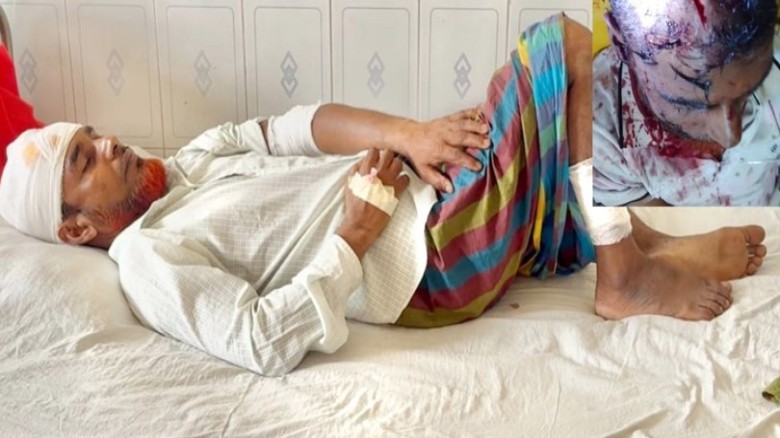 ধনবাড়ীতে পল্লী চিকিৎসককে কুপিয়ে হত্যা চেষ্টা